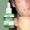 Private Label 2% Salicylic Acid Anti-acne Face Serum