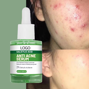 Private Label 2% Salicylic Acid Anti-acne Face Serum