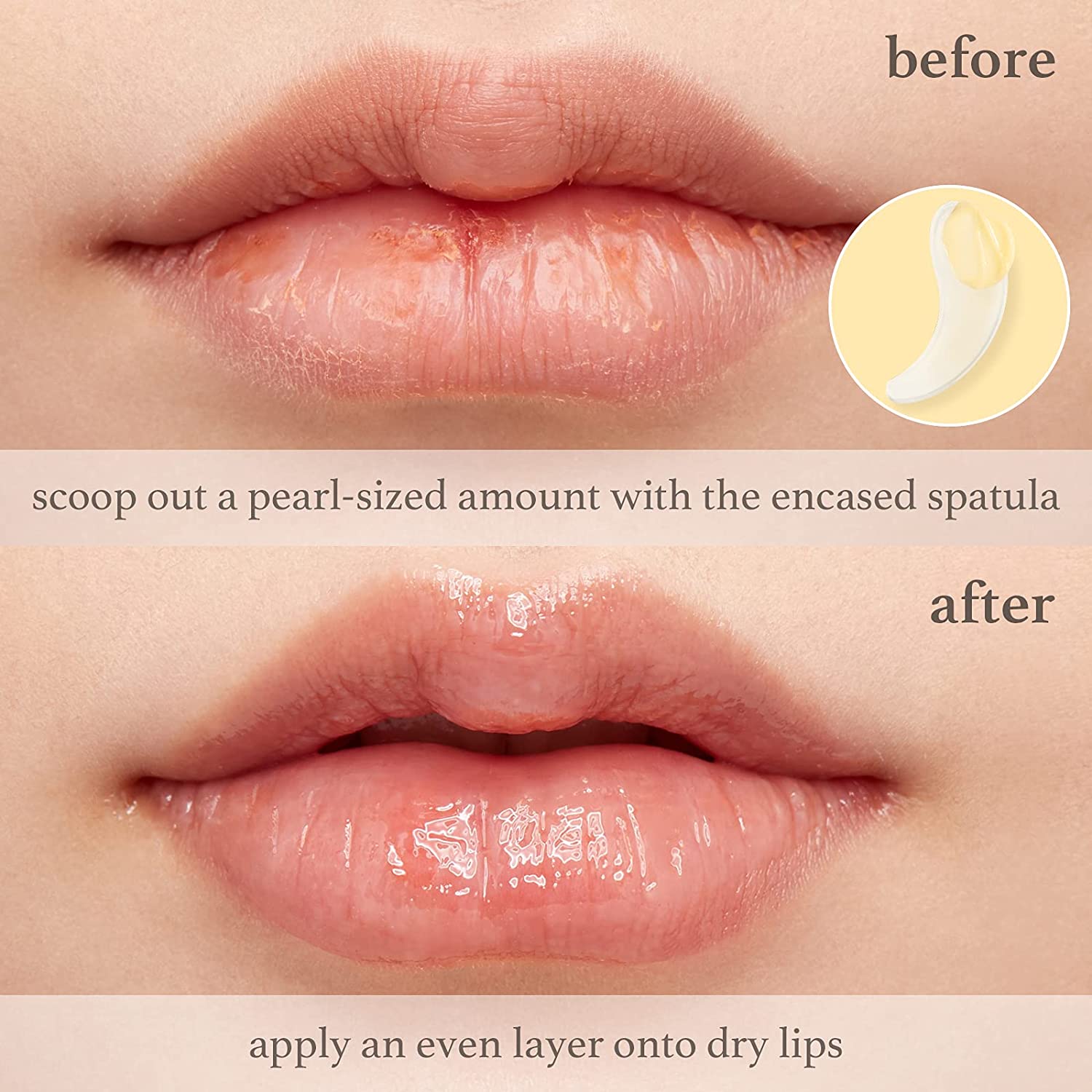 Lip Balm